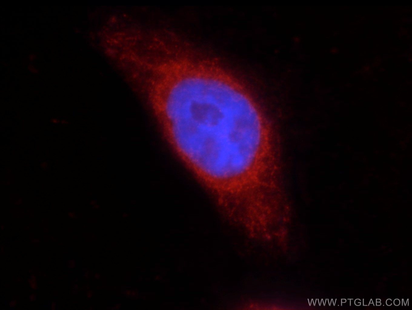 COX2/ Cyclooxygenase 2/ PTGS2