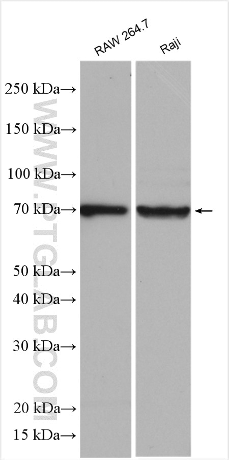 Western Blot (WB) analysis of various lysates using COX2/ Cyclooxygenase 2/ PTGS2 Polyclonal antibody (12375-1-AP)