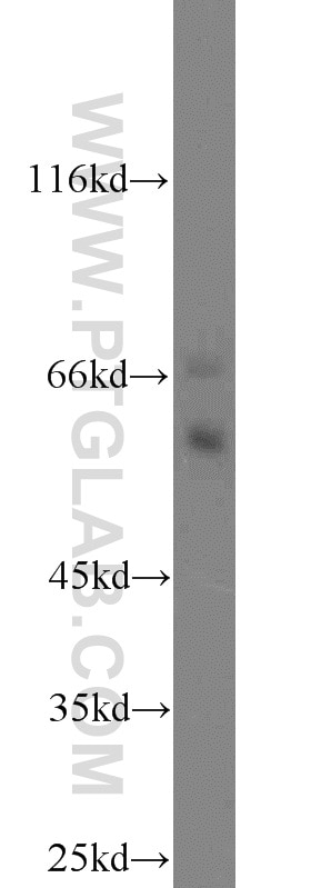 COX2/ Cyclooxygenase 2/ PTGS2 Polyclonal antibody