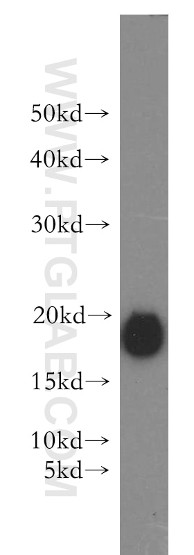 Western Blot (WB) analysis of Recombinant protein using PTH-Specific Polyclonal antibody (19001-1-AP)