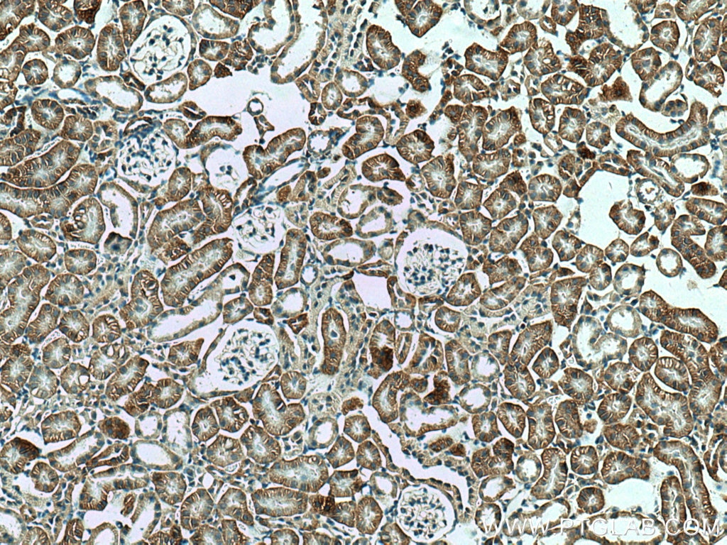 Immunohistochemistry (IHC) staining of mouse kidney tissue using PTH1R Polyclonal antibody (24275-1-AP)