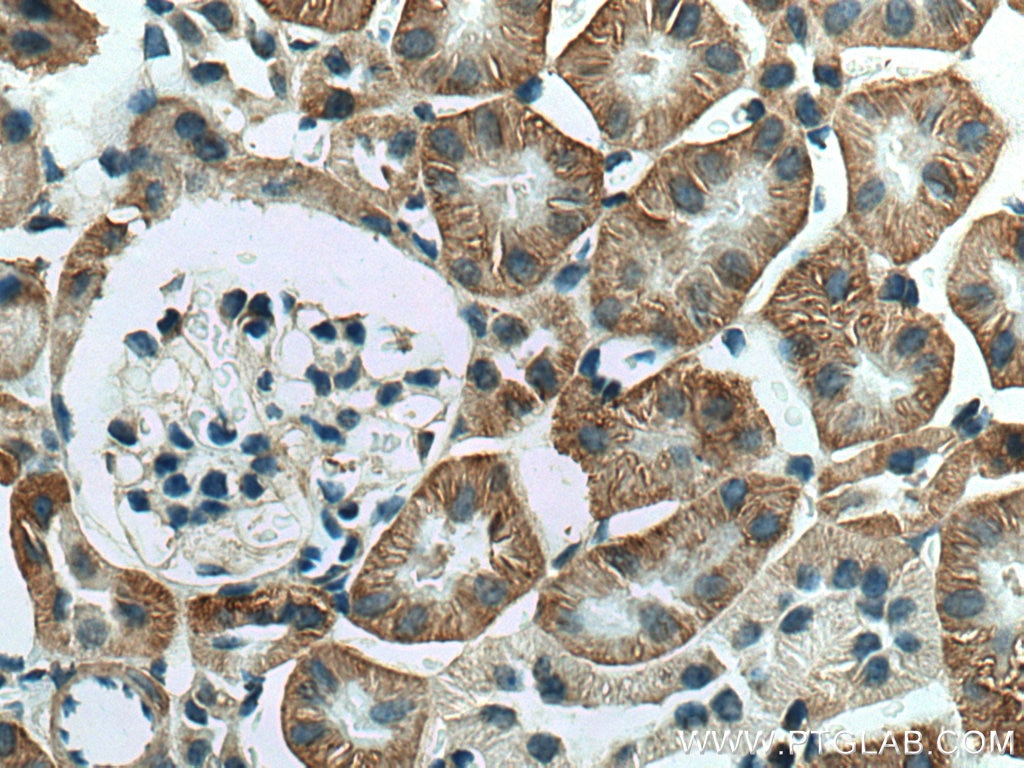 Immunohistochemistry (IHC) staining of mouse kidney tissue using PTH1R Polyclonal antibody (24275-1-AP)
