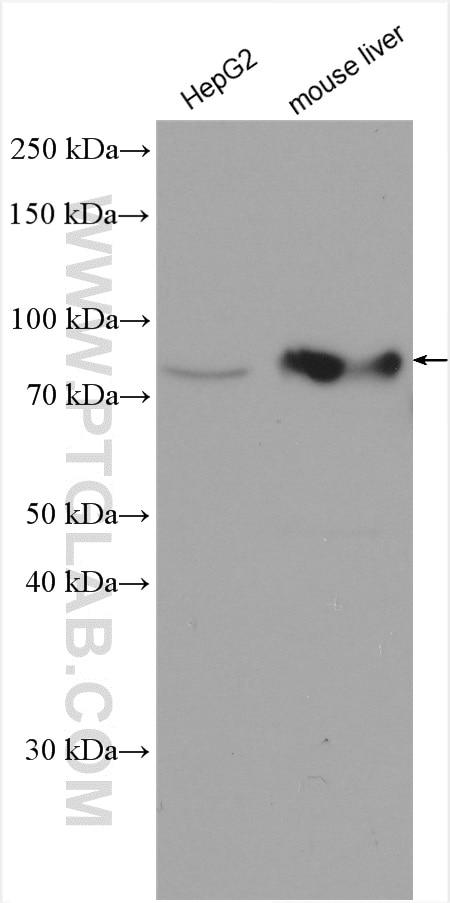 Western Blot (WB) analysis of various lysates using PTH1R Polyclonal antibody (24275-1-AP)