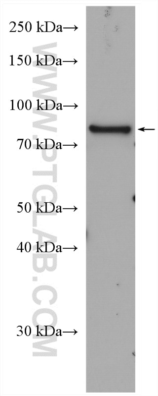 Western Blot (WB) analysis of U2OS cells using PTH1R Polyclonal antibody (24275-1-AP)