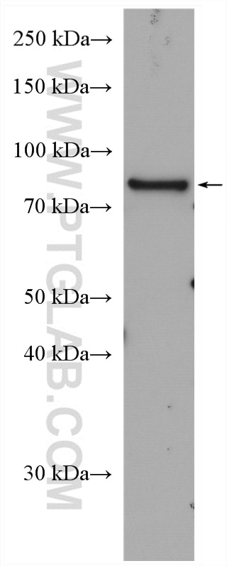 WB analysis of U2OS using 24275-1-AP