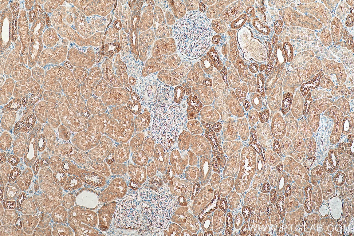 Immunohistochemistry (IHC) staining of human kidney tissue using PTH1R Polyclonal antibody (29115-1-AP)