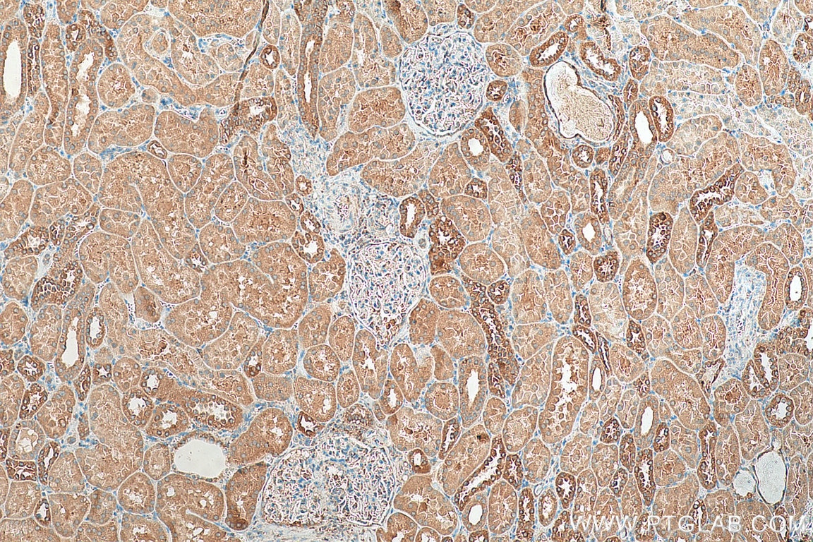 IHC staining of human kidney using 29115-1-AP