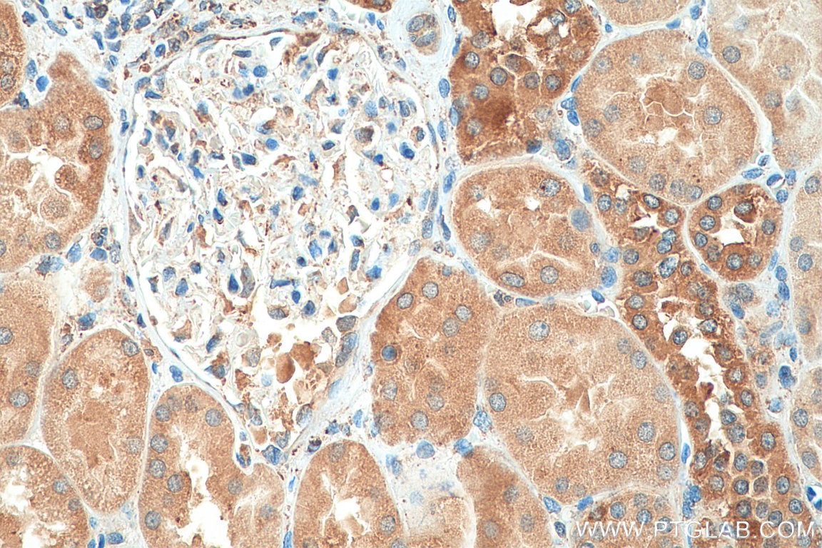 Immunohistochemistry (IHC) staining of human kidney tissue using PTH1R Polyclonal antibody (29115-1-AP)