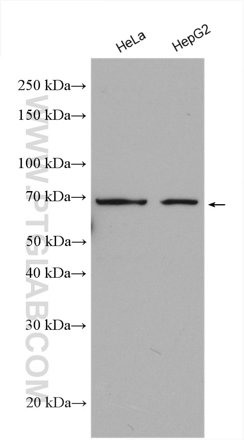 Western Blot (WB) analysis of various lysates using PTH1R Polyclonal antibody (29115-1-AP)