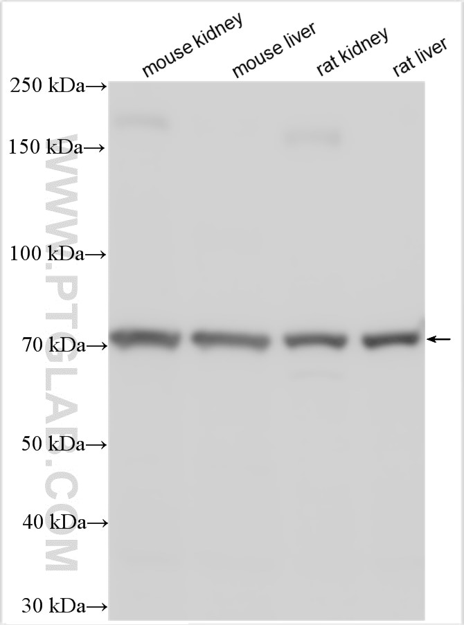 Western Blot (WB) analysis of various lysates using PTH1R Polyclonal antibody (29115-1-AP)