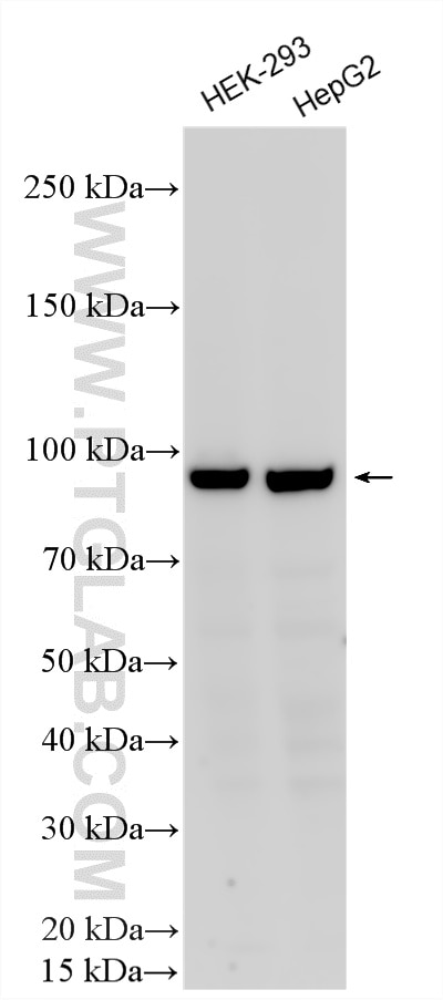 WB analysis using 29115-1-AP Western Blot (WB) analysis of various lysates using PTH1R Polyclonal antibody (29115-1-AP)