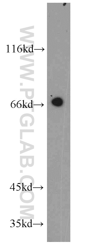 Western Blot (WB) analysis of mouse liver tissue using PTH2R Polyclonal antibody (14166-1-AP)