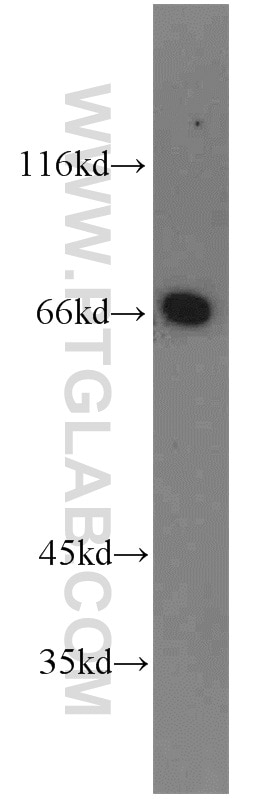 Western Blot (WB) analysis of human testis tissue using PTH2R Polyclonal antibody (14166-1-AP)