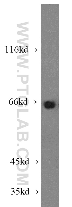 Western Blot (WB) analysis of L02 cells using PTH2R Polyclonal antibody (14166-1-AP)