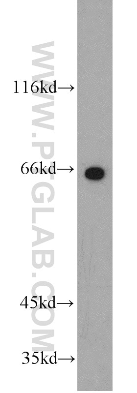 Western Blot (WB) analysis of mouse testis tissue using PTH2R Polyclonal antibody (14166-1-AP)