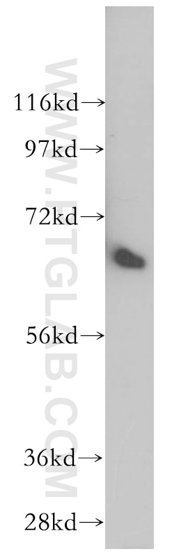 Western Blot (WB) analysis of mouse pancreas tissue using PTH2R Polyclonal antibody (14166-1-AP)