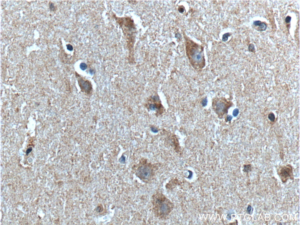 Immunohistochemistry (IHC) staining of human brain tissue using PTHLH Polyclonal antibody (10817-1-AP)