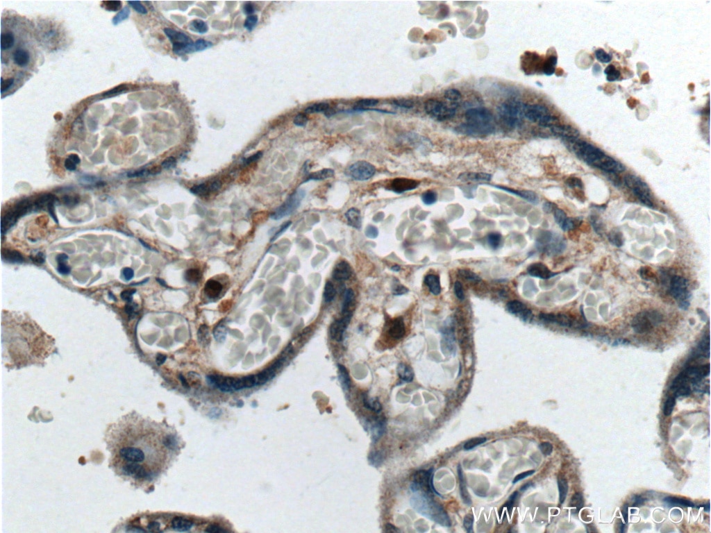 Immunohistochemistry (IHC) staining of human placenta tissue using PTHLH Polyclonal antibody (10817-1-AP)