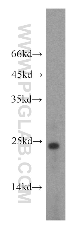 PTHLH Polyclonal antibody