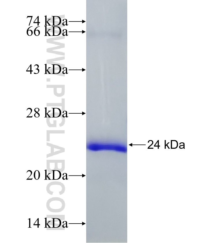 PTHLH fusion protein Ag33707 SDS-PAGE PTHLH fusion protein Ag33707 SDS-PAGE
