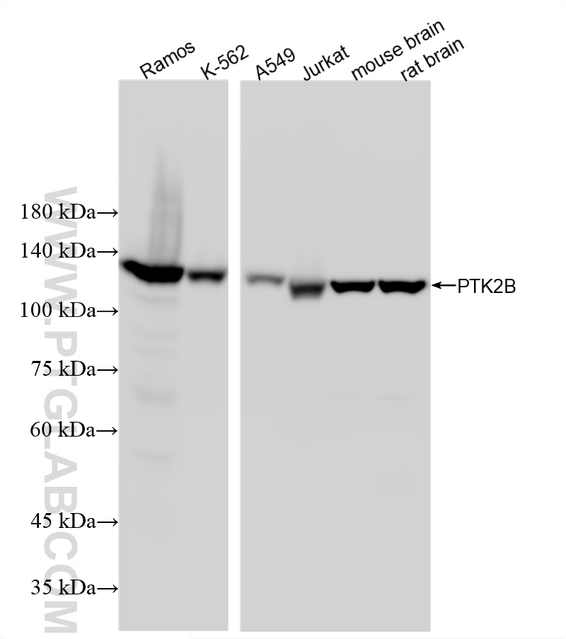 WB analysis using 87746-1-RR Western Blot (WB) analysis of various lysates using PYK2 Recombinant monoclonal antibody (87746-1-RR)