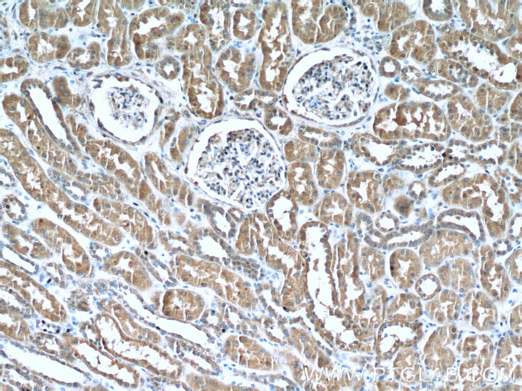 Immunohistochemistry (IHC) staining of human kidney tissue using PYK2 Polyclonal antibody (10044-2-AP)