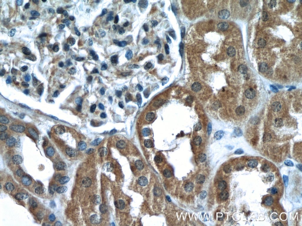 Immunohistochemistry (IHC) staining of human kidney tissue using PYK2 Polyclonal antibody (10044-2-AP)