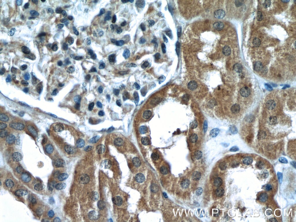 IHC staining of human kidney using 10044-2-AP