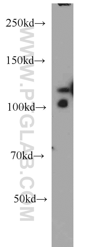 Western Blot (WB) analysis of Jurkat cells using PYK2 Polyclonal antibody (10044-2-AP)