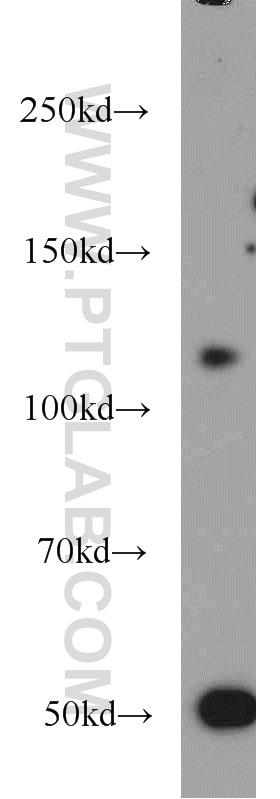 Western Blot (WB) analysis of mouse brain tissue using PYK2 Polyclonal antibody (10044-2-AP)