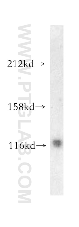 Western Blot (WB) analysis of mouse brain tissue using PYK2 Polyclonal antibody (10044-2-AP)