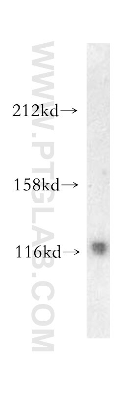 Western Blot (WB) analysis of mouse brain tissue using PYK2 Polyclonal antibody (10044-2-AP)