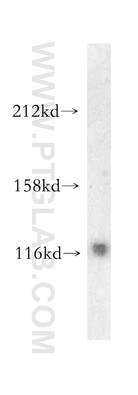 Western Blot (WB) analysis of mouse brain tissue using PYK2 Polyclonal antibody (10044-2-AP)