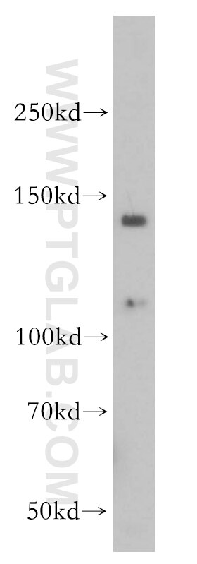 Western Blot (WB) analysis of mouse brain tissue using PYK2 Polyclonal antibody (10044-2-AP)