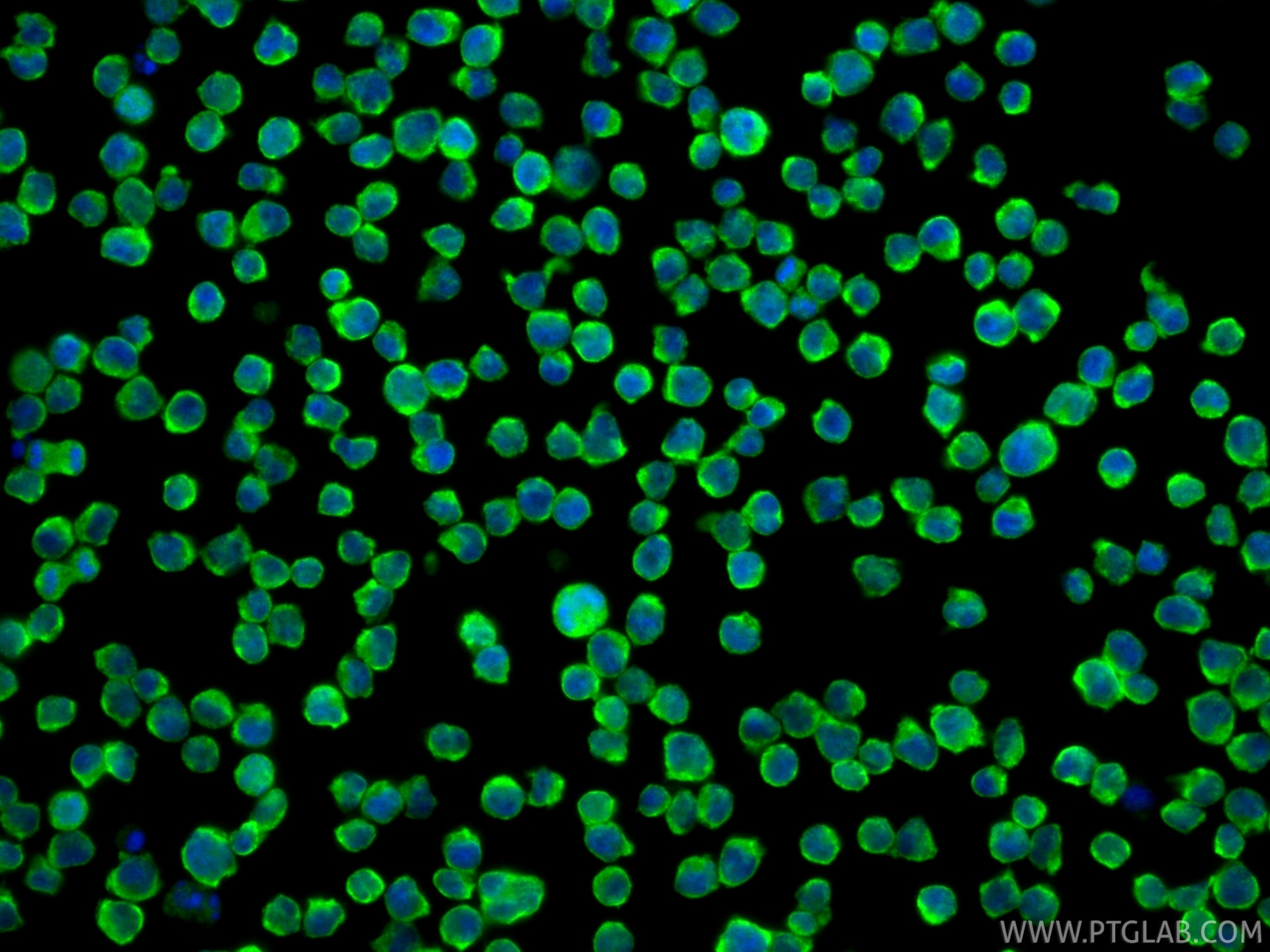 Immunofluorescence (IF) / fluorescent staining of Jurkat cells using PYK2 Polyclonal antibody (17592-1-AP)