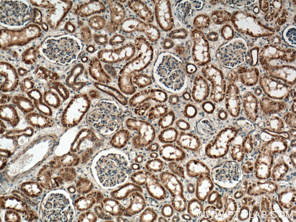 Immunohistochemistry (IHC) staining of human kidney tissue using PYK2 Polyclonal antibody (17592-1-AP)