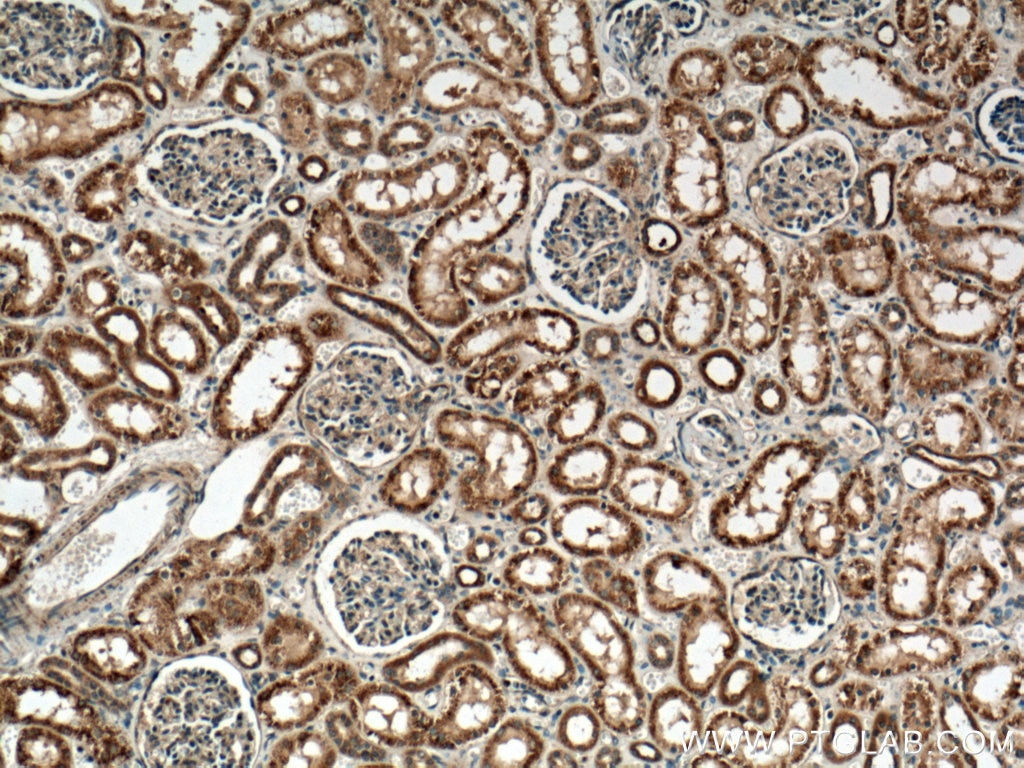 IHC staining of human kidney using 17592-1-AP