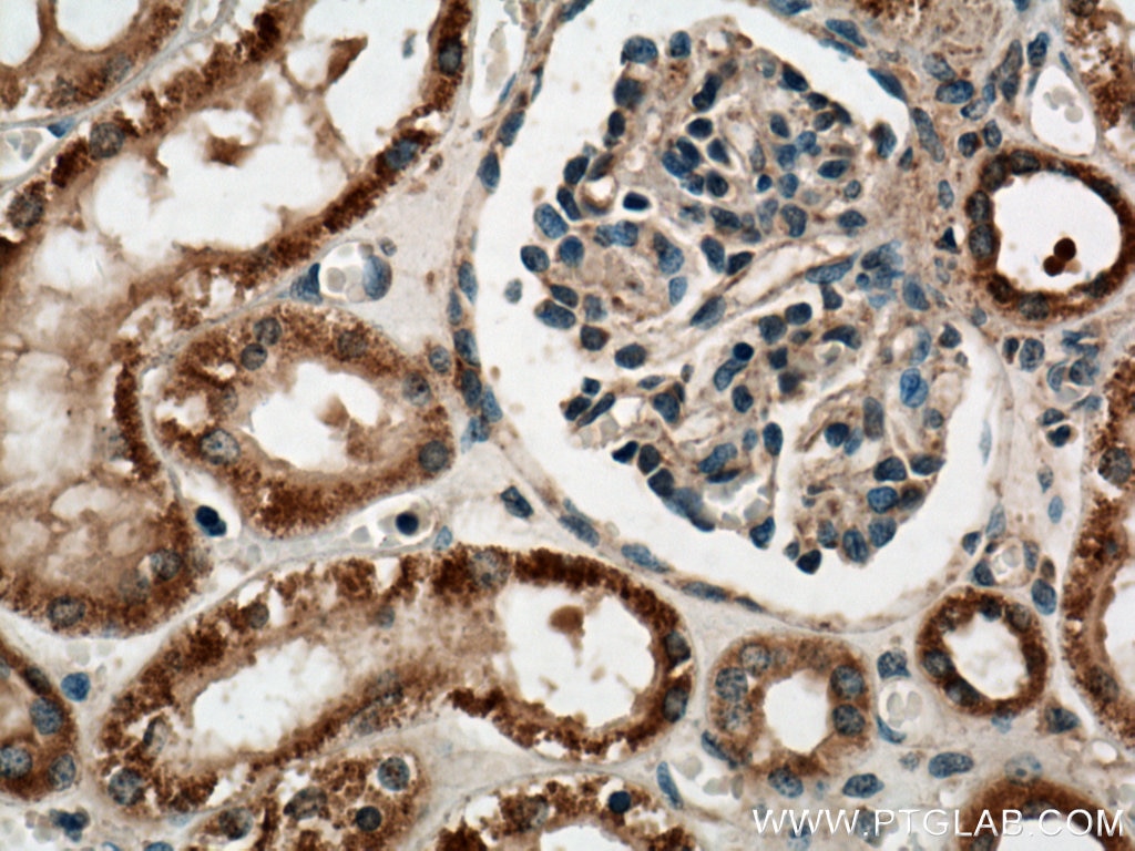 Immunohistochemistry (IHC) staining of human kidney tissue using PYK2 Polyclonal antibody (17592-1-AP)