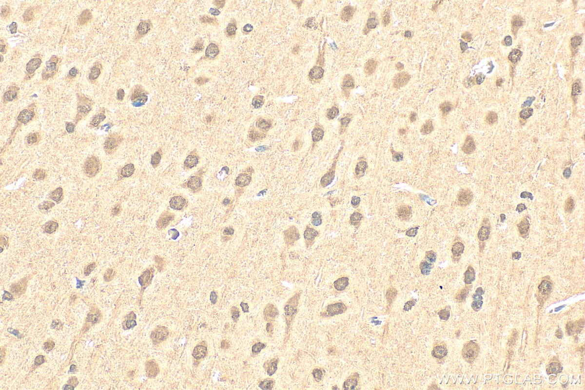 Immunohistochemistry (IHC) staining of rat brain tissue using PYK2 Polyclonal antibody (17592-1-AP)