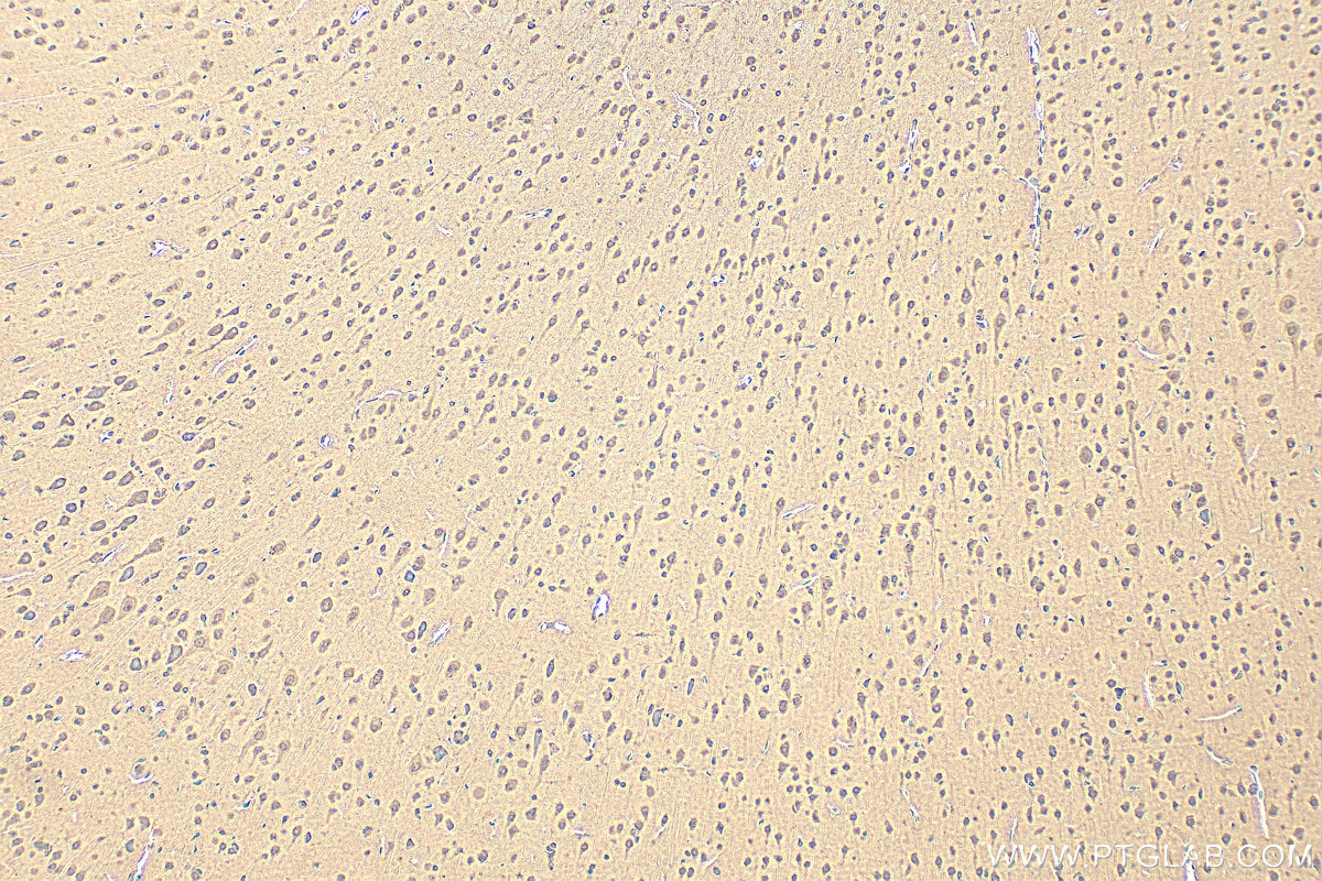 Immunohistochemistry (IHC) staining of rat brain tissue using PYK2 Polyclonal antibody (17592-1-AP)