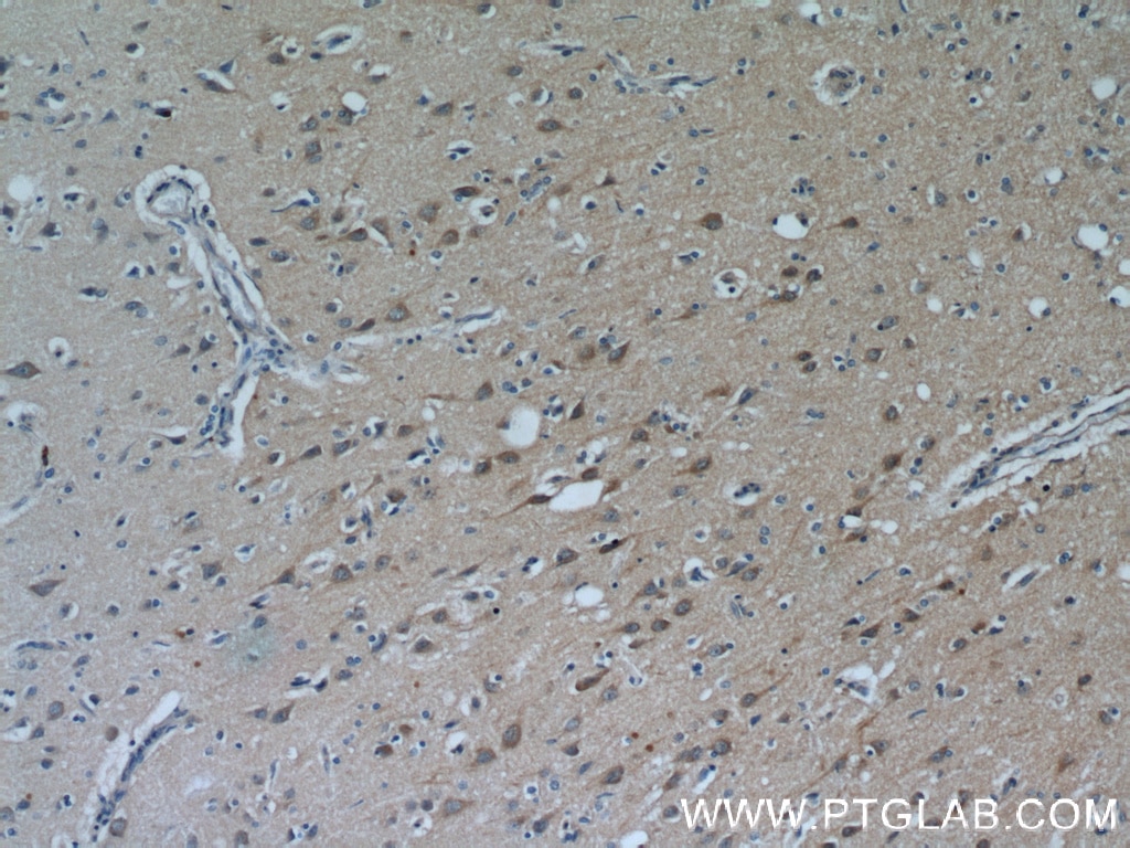 Immunohistochemistry (IHC) staining of human brain tissue using PYK2 Polyclonal antibody (17592-1-AP)