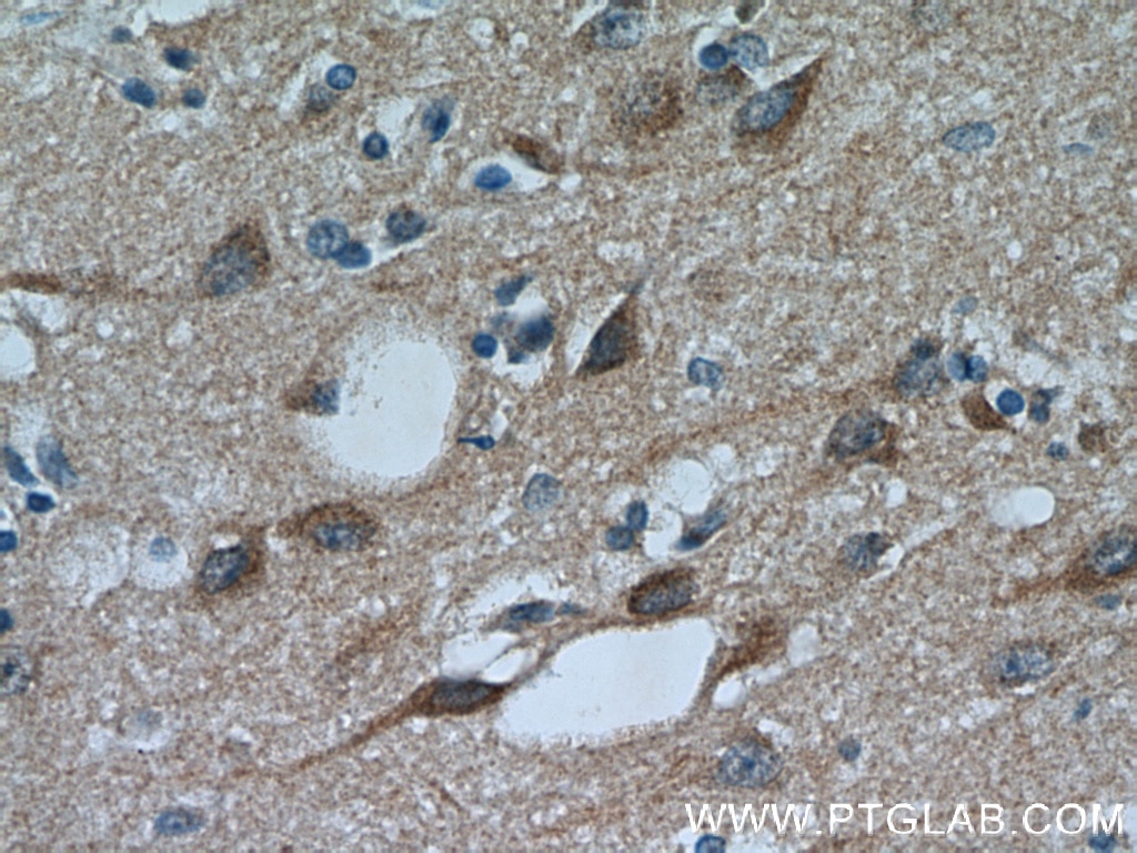 Immunohistochemistry (IHC) staining of human brain tissue using PYK2 Polyclonal antibody (17592-1-AP)