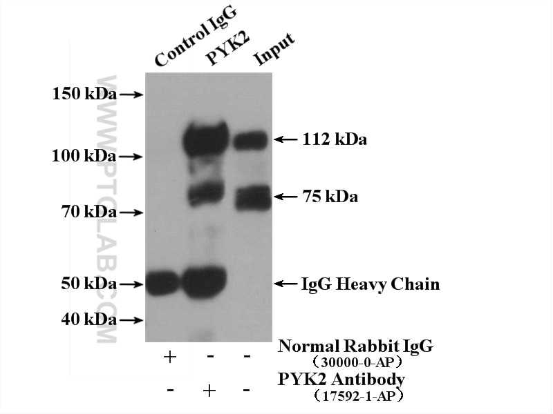 Immunoprecipitation (IP) experiment of mouse brain tissue using PYK2 Polyclonal antibody (17592-1-AP)