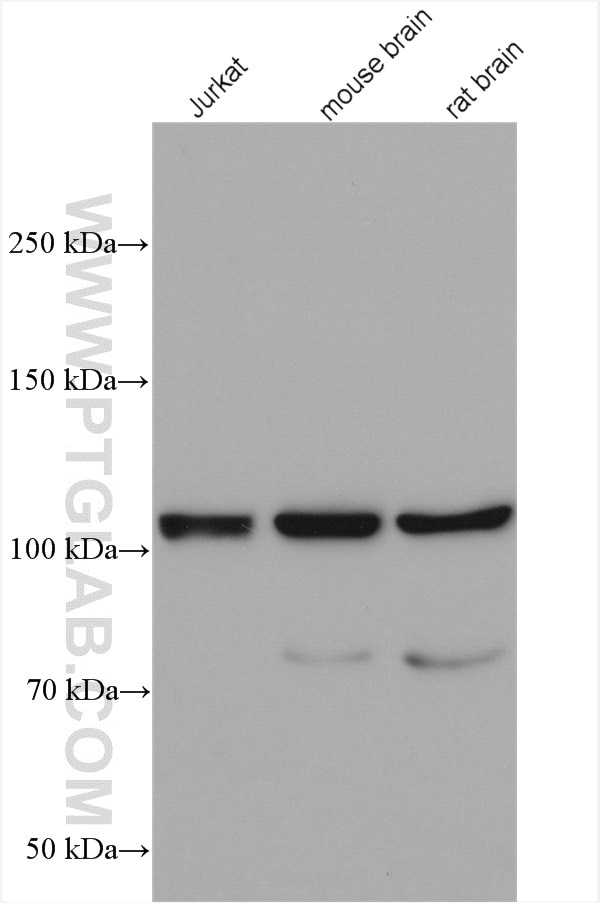 Western Blot (WB) analysis of various lysates using PYK2 Polyclonal antibody (17592-1-AP)