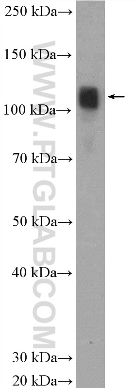 Western Blot (WB) analysis of rat brain tissue using PYK2 Polyclonal antibody (17592-1-AP)