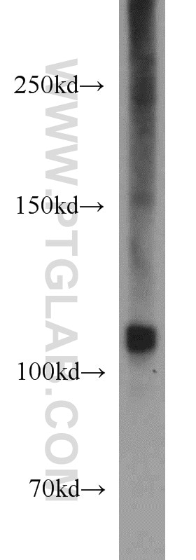 PYK2 Polyclonal antibody