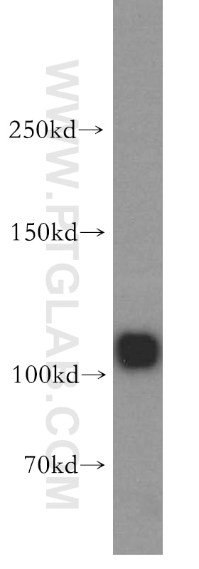 Western Blot (WB) analysis of Jurkat cells using PYK2 Polyclonal antibody (17592-1-AP)