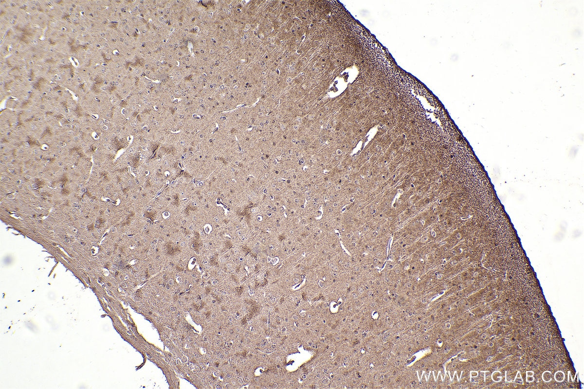 Immunohistochemistry (IHC) staining of mouse brain tissue using PYK2 Monoclonal antibody (67141-1-Ig)