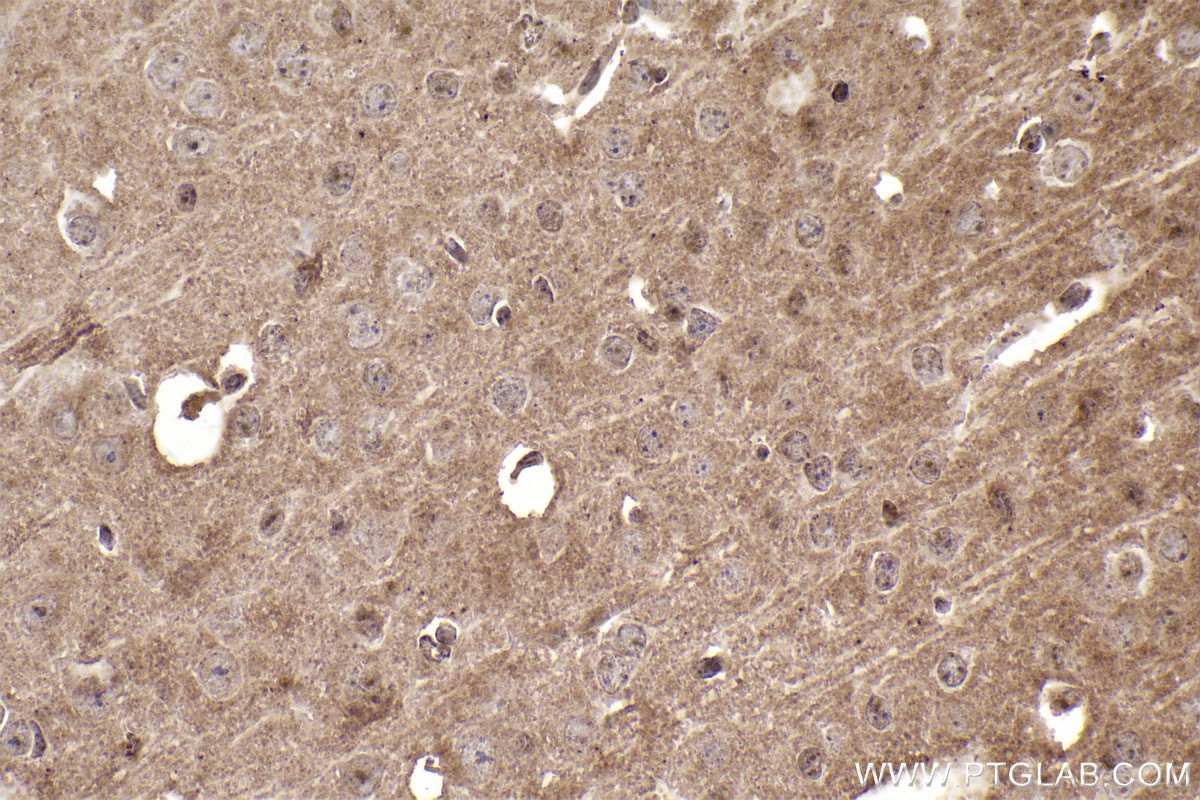 Immunohistochemistry (IHC) staining of mouse brain tissue using PYK2 Monoclonal antibody (67141-1-Ig)