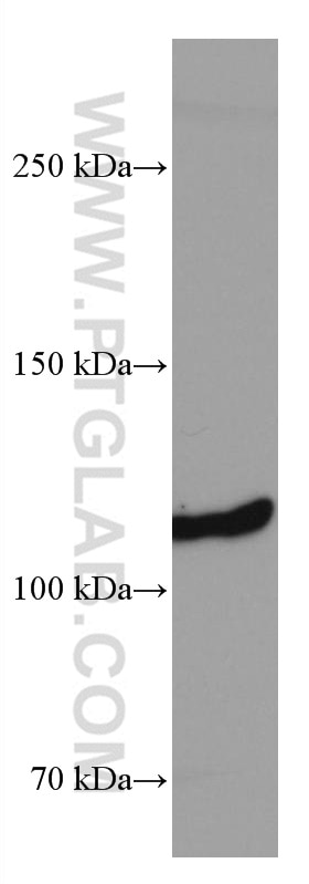 Western Blot (WB) analysis of mouse brain tissue using PTK2B Monoclonal antibody (67141-1-Ig)